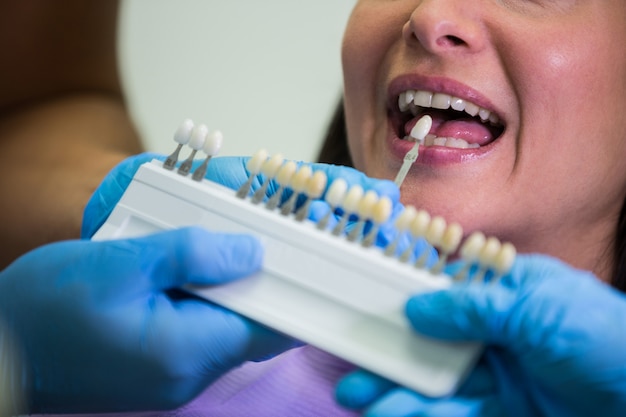 Benefits of Single Tooth Implants