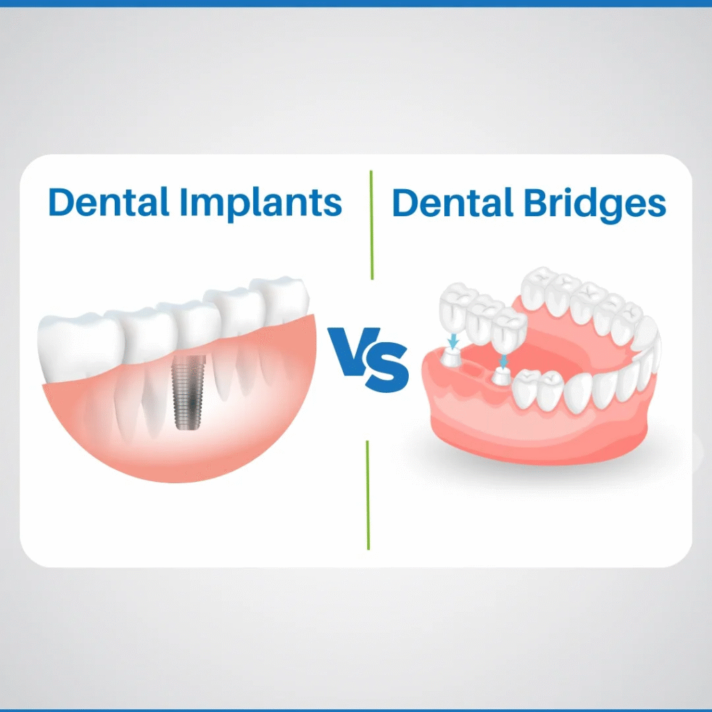 Single Tooth Replacement Options