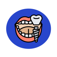 Full Mouth Dental Implants