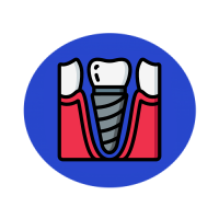 One Day Dental Implants