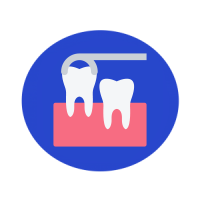 Tooth Replacement